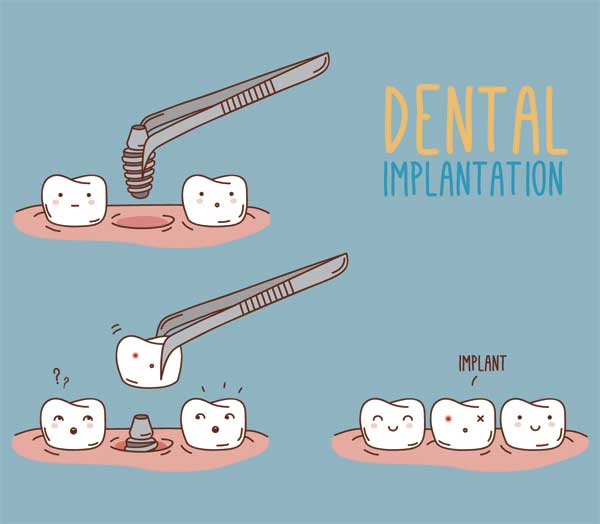 An illustration with a blue background that shows a short summary on what happen during dental implantation, the teeth have different reations