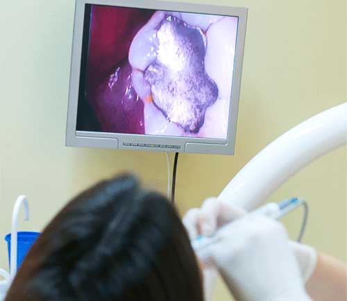 A patient being examined by a dentist with a intra-oral video examination and the results are showing in a screen in front of the patient