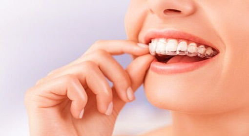 Best place to get Invisalign treatment in Buena Park, California