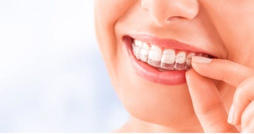 You can remove Invisalign while eating, drinking, brushing or flossing
