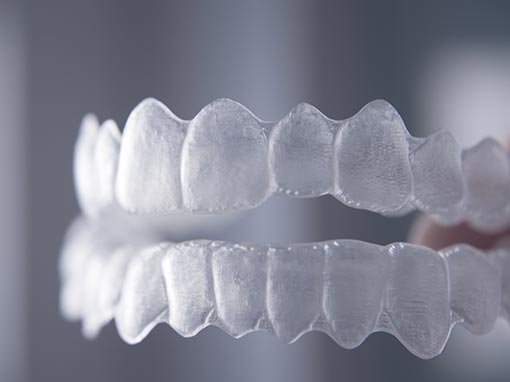 Smile Brite Dental have Invisalign expert staff 