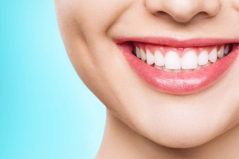 The Impact of a Smile Makeover on Self-Confidence