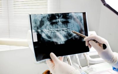 How Regular Dental Exams Help Avoid Costly Dental Problems