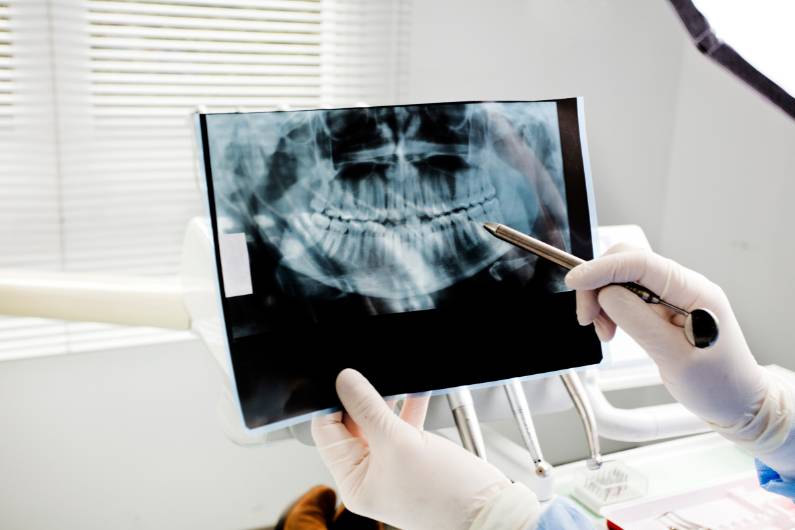 Dentist checking panoramic xray